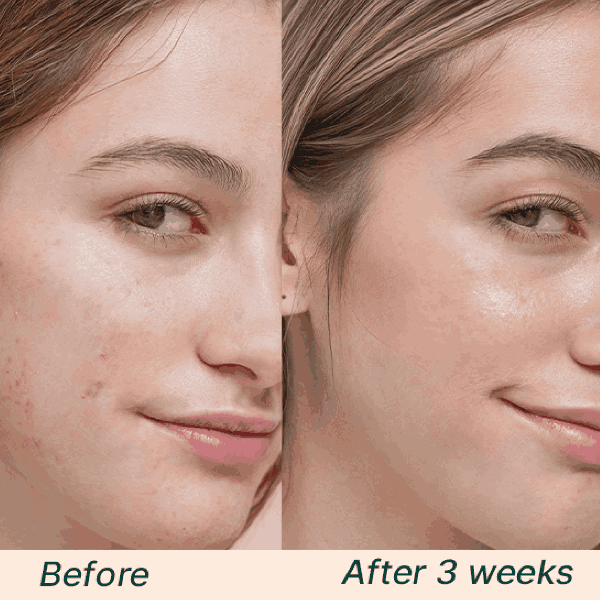 Hyaluronic Acid Face Toner and Facial Mist - Image 5