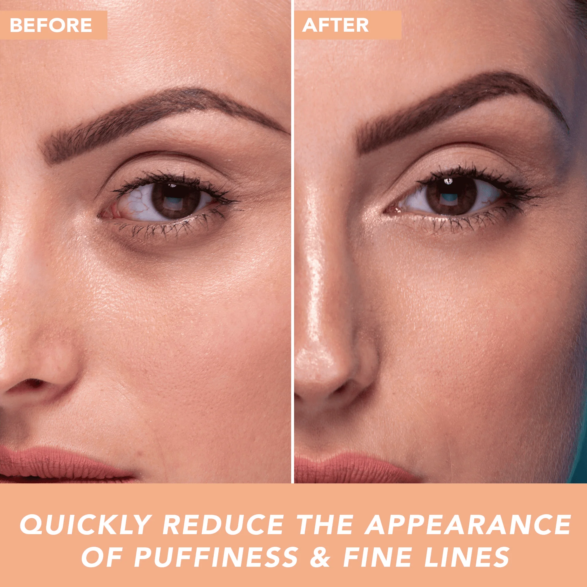 Hyaluronic Acid Quad Bundle - Image 7