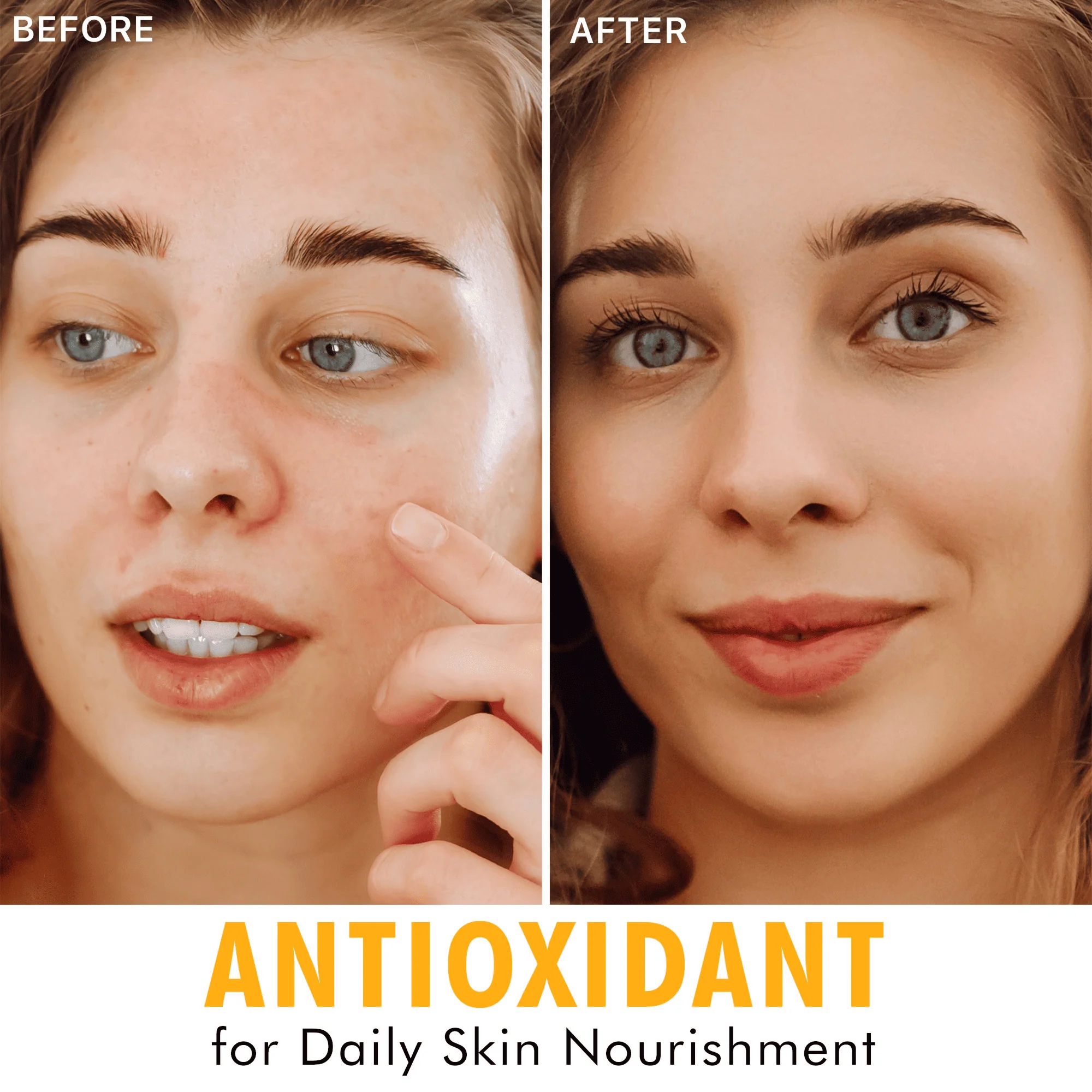 Hyperactive Anti-Aging® Vitamin C Duo - Image 6